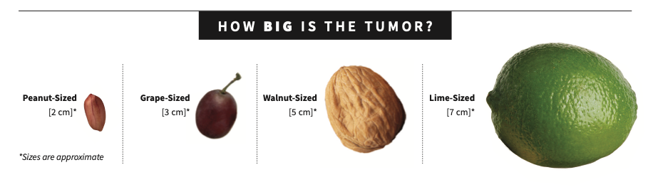 tumor-size-centimeters-image-details-nci-visuals-online-vlr-eng-br